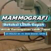 Pemeriksaan Mammografi Kini Hadir di RSUD Bob Bazar, Lebih Dekat untuk Melayani Masyarakat Lampung Selatan