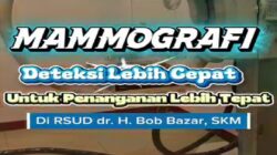 Pemeriksaan Mammografi Kini Hadir di RSUD Bob Bazar, Lebih Dekat untuk Melayani Masyarakat Lampung Selatan